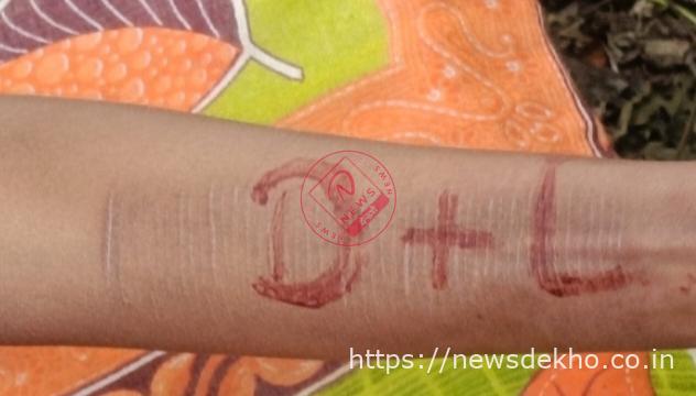 नाबालिग लड़की का पेड़ से लटकता शव मिलने से मचा हड़कंप, हाथ पर लिखे D+L ने बढ़ाया रहस्य